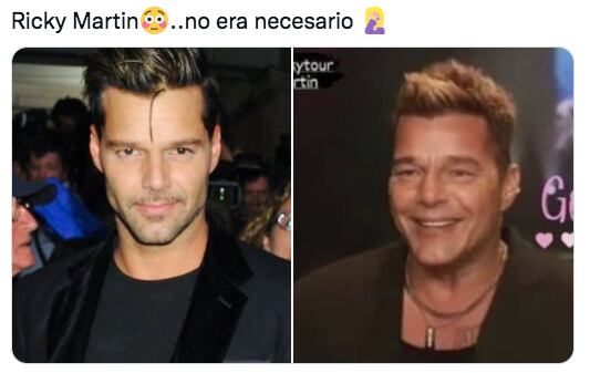 Se burlan del rostro de Ricky Martin