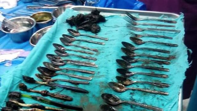 El joven sufre atrofia cerebral.