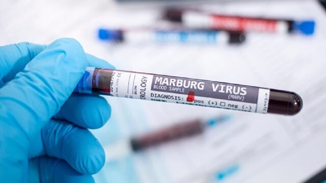 Virus de Marburgo