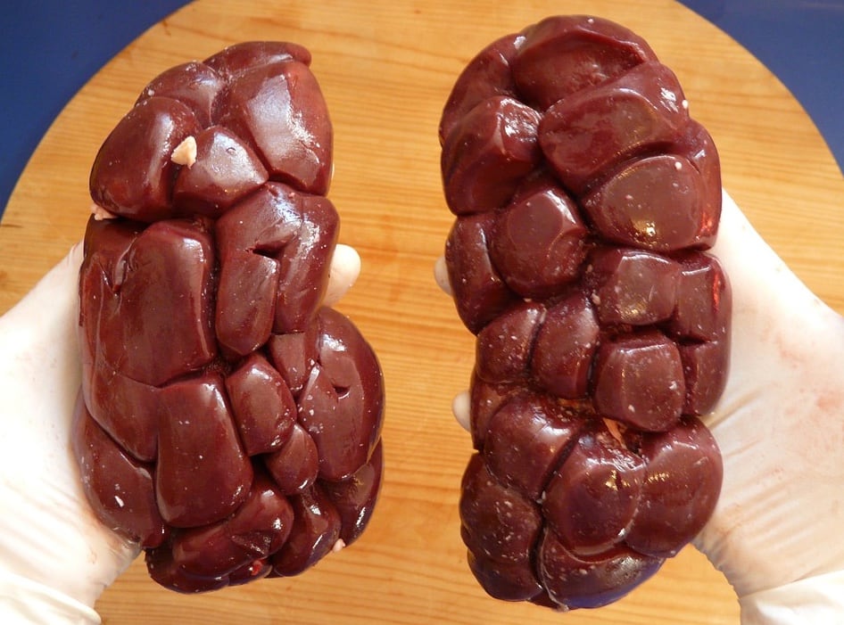 Riñones, imagen ilustrativa