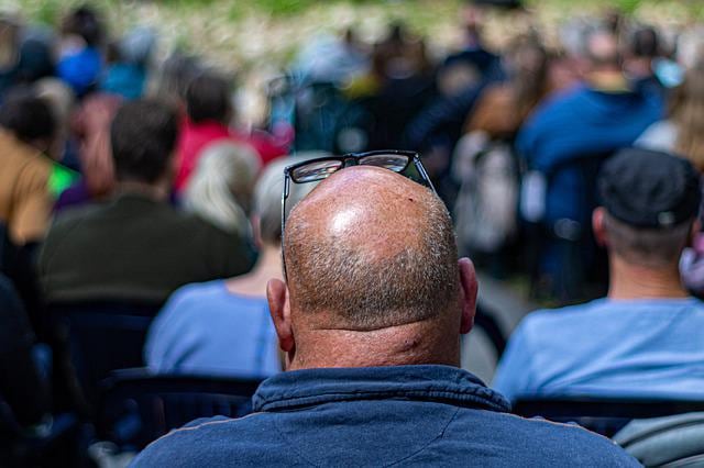 Alopecia