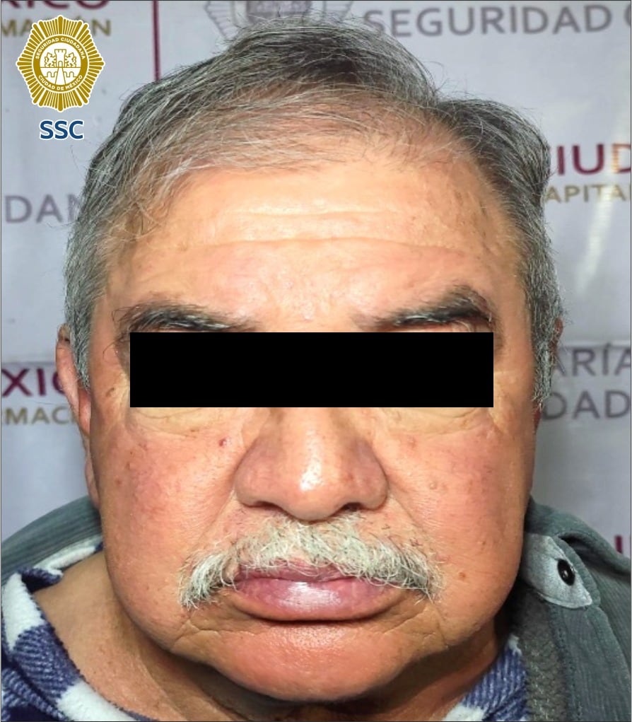 Golpe a la Anti-Unión Tepito