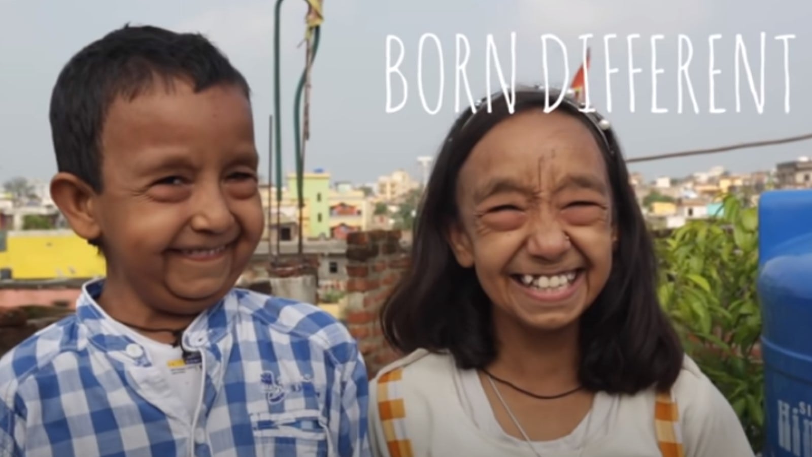 Hermanos con Progeria