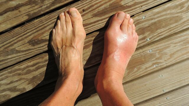 Daños en la piel de los pies