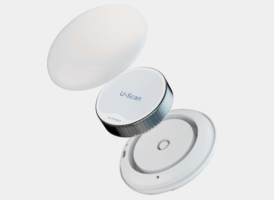 U-Scan, dispositivo que solo necesita de tu orina para detectar problemas de salud