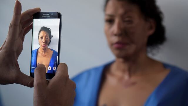 Se debe considerar como prioritaria la atención a los actos de violencia con ácidos