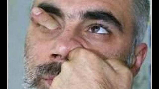 El vicio que todos compartimos: picarnos la nariz