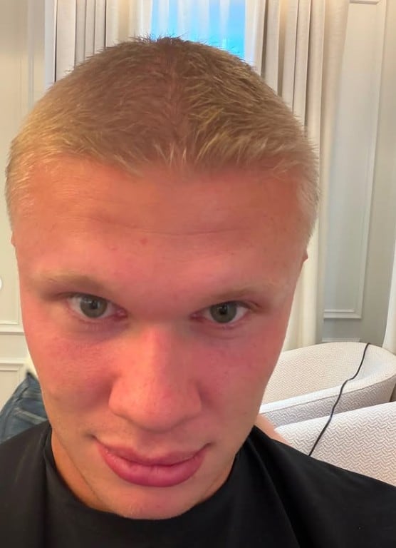 Nuevo corte de Erling Haaland