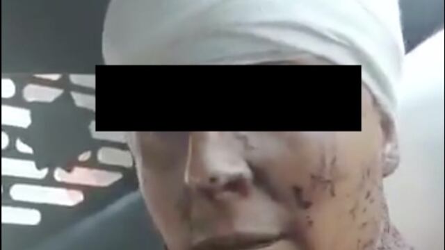 El sujeto confesó haber asesinado y desollado a su pareja.