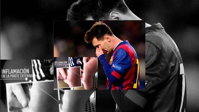 FOTO: Tras rumores publican la imagen del pie inflamado de Lionel Messi