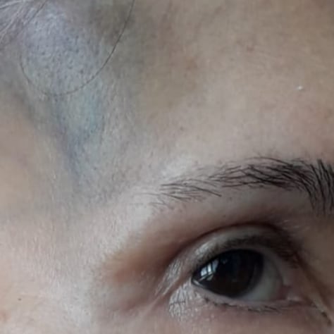 Florinda Meza sufre accidente