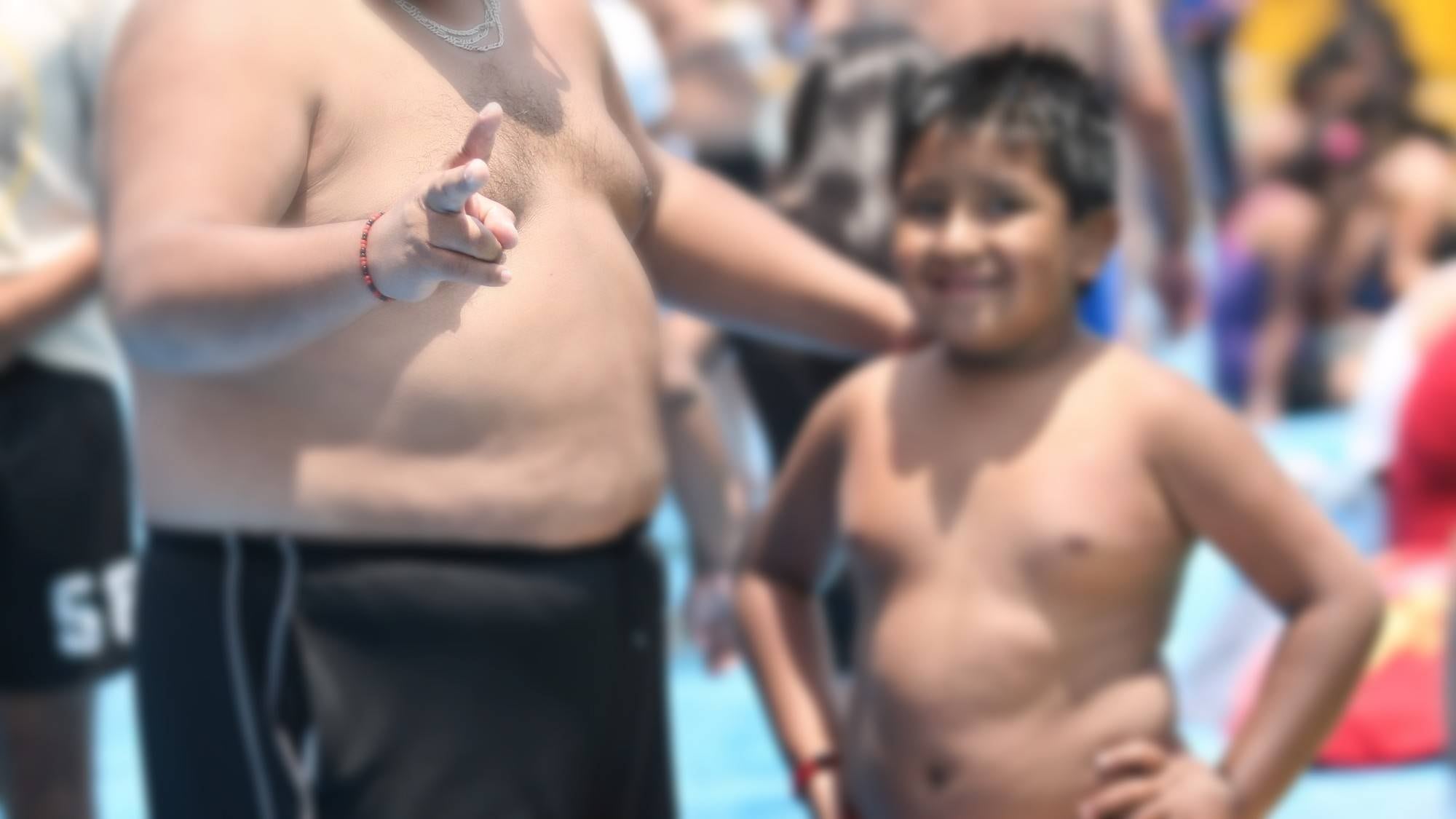Obesidad Infantil