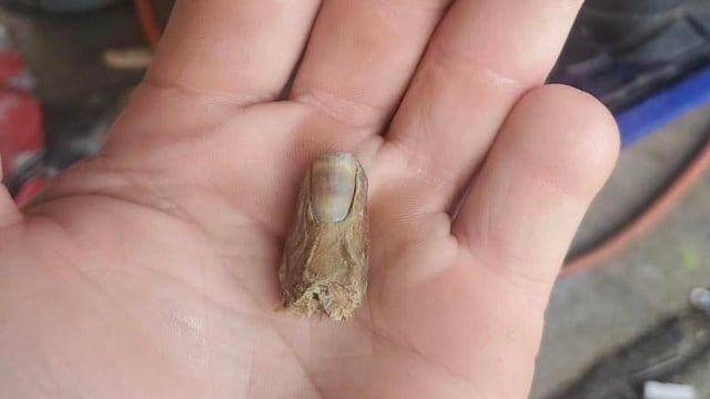 Joven se amputa el dedo al utilizar una sierra eléctrica