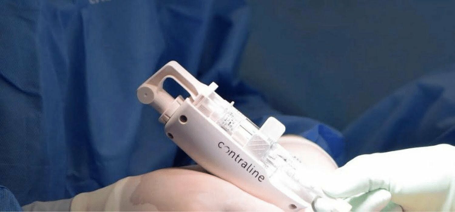 El anticonceptivo ADAM para hombre que impide que los espermas salgan cuando termines