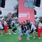 Gran Premio de México: Juega a saltar la cuerda y se fractura la pierna (VIDEO)