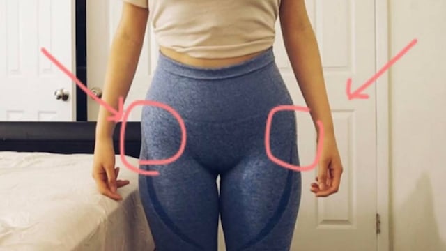 Son huequitos que se hacen entre la cadera y las piernas.