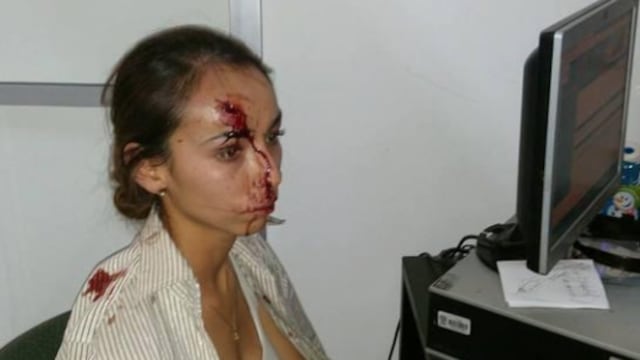 Karla Silva, atacada a golpes en las oficinas de El Heraldo, la tarde del pasado 4 de septiembre, dijo que se siente mejor y sigue recuperándose. Foto/Especial