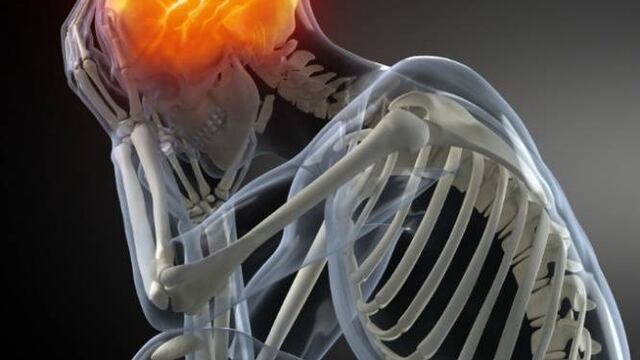 No dejes pasar un "simple dolor de cabeza"