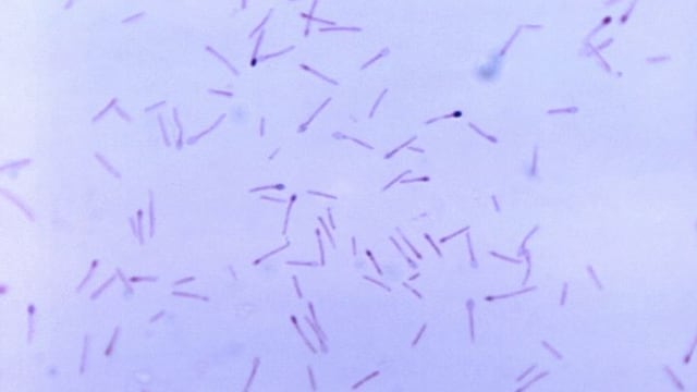 Bacteria Clostrydium botulinum causante del botulismo