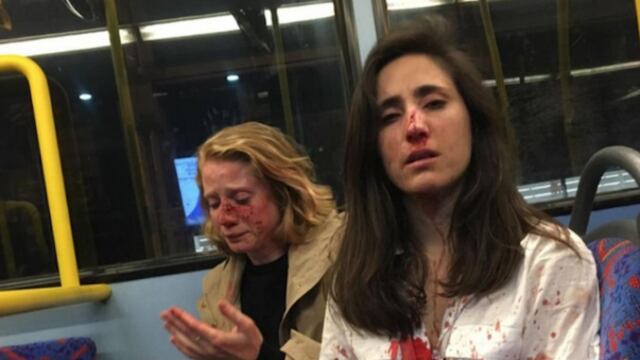 Golpean a pareja de lesbianas en Londres.