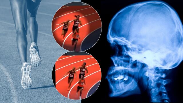 Brutal agresión en plena carrera; le pegó en la cabeza con el testigo y le fracturó el cráneo.