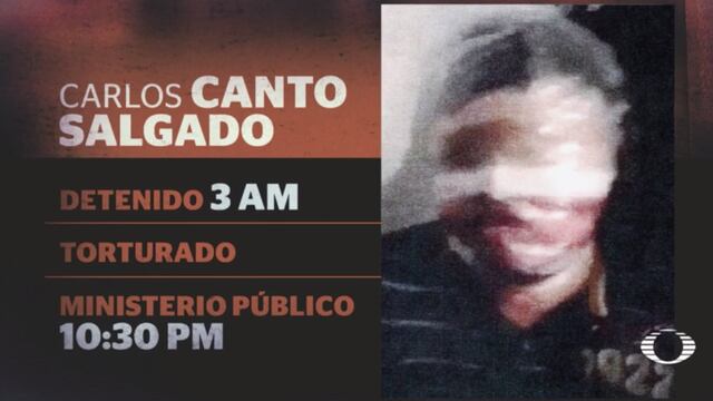 Carlos Canto, víctima de tortura