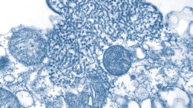 ¿Qué es el virus Nipah?