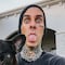 ¿Qué le pasó a Travis Barker? Un accidente le costaría la gira mundial a Blink-182