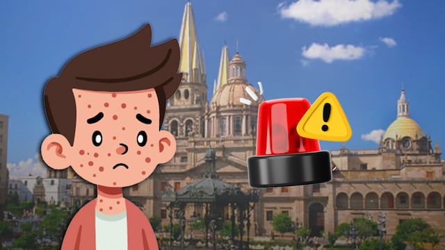 OPS emite alerta sanitaria por sarampión en América.