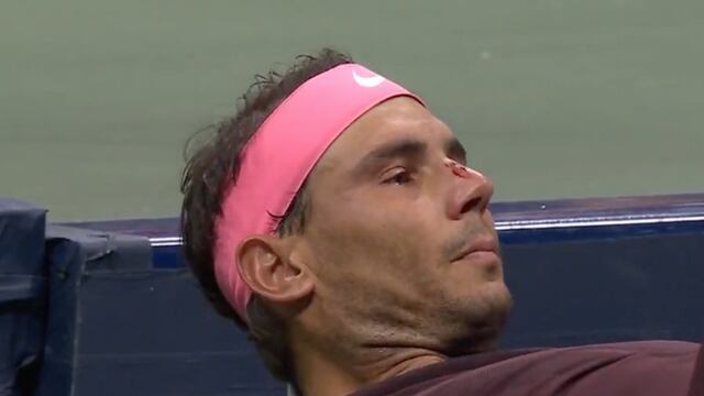 Rafa Nadal tuvo un accidente en el US Open