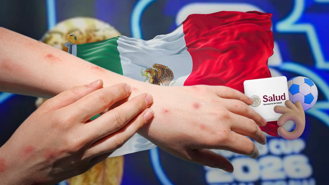 Salud prevé controlar brote de sarampión antes del Mundial 2026