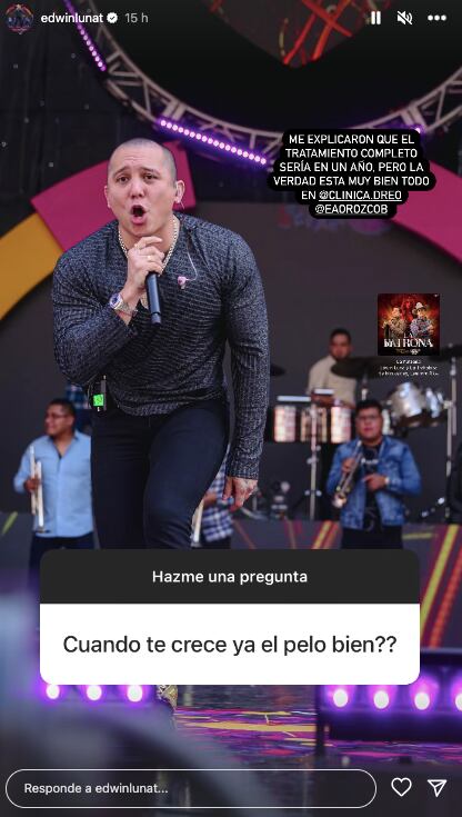 Pregunta a Edwin Luna cuándo le crecerá el cabello
