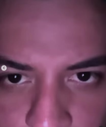 A Eduin Caz lo pica una avispa