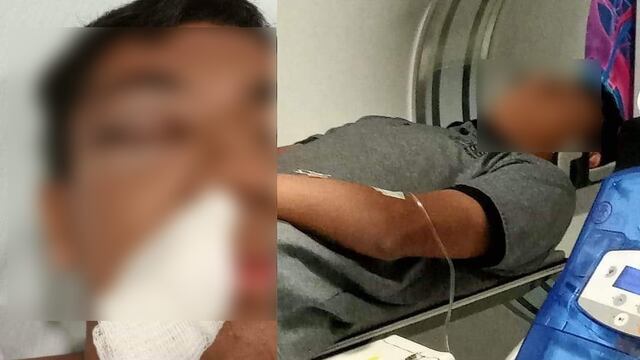 Golpean a estudiante de Altamira, Tamaulipas con una manopla con clavos