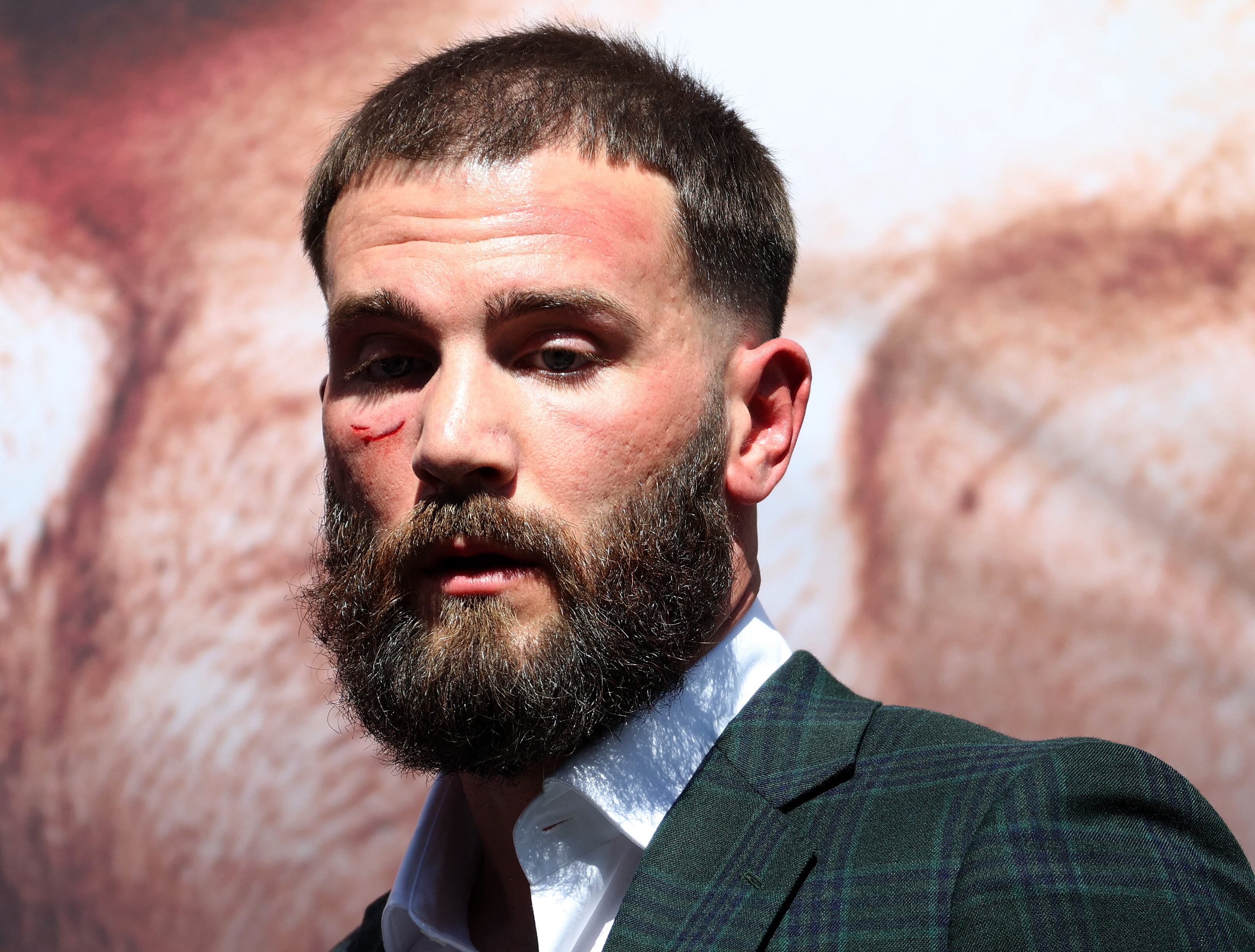 Caleb Plant sufrió un corte en el rostro tras pleito en el careo vs Canelo