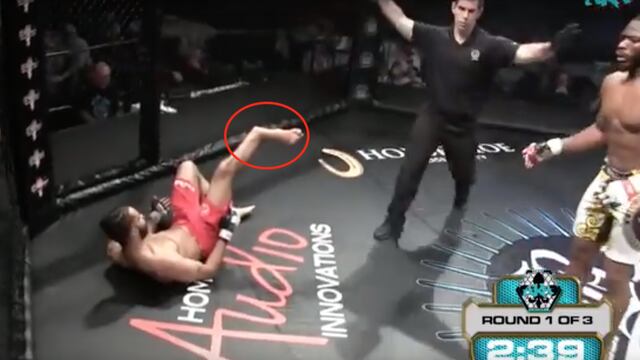 King sufrió una brutal fractura