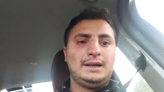 Hombre agredido en Paracho