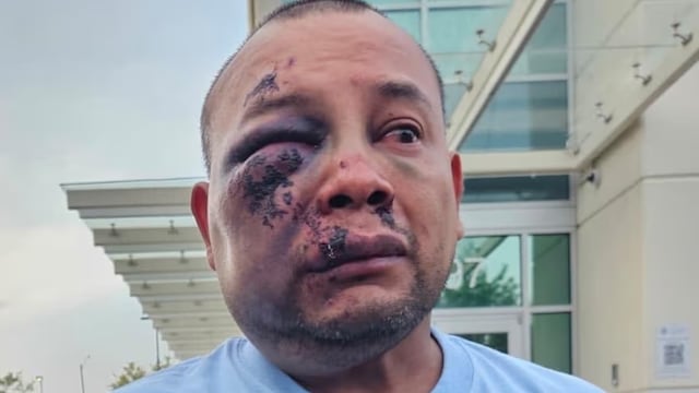 José Mejía Hernández denuncia maltrato por parte de agentes de ICE