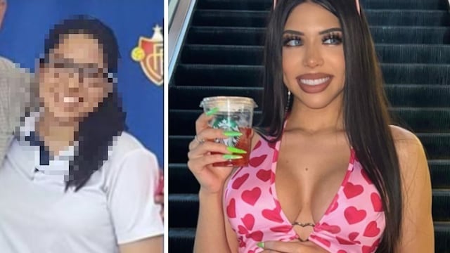 Yeri Mua antes y después de operaciones