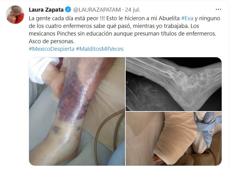 Laura Zapata denuncia negligencia en cuidados de Eva Mange
