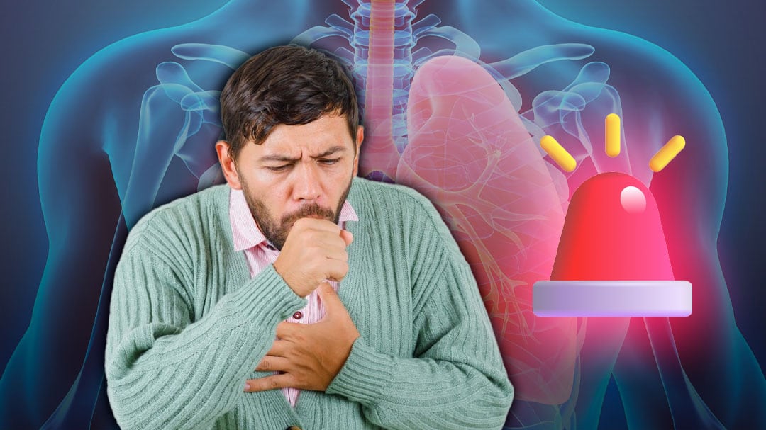 Tos ferina en México: Casos hasta al 18 de marzo 2025; estados en alerta