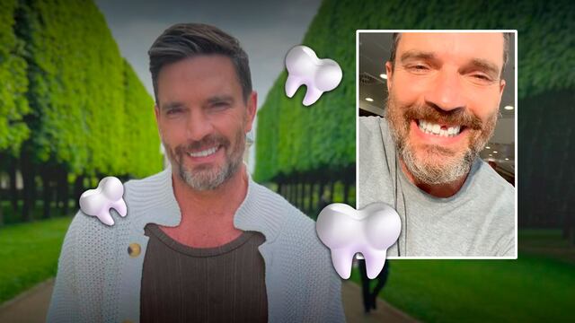 Julián Gil apareció chimuelo por una dolorosa razón