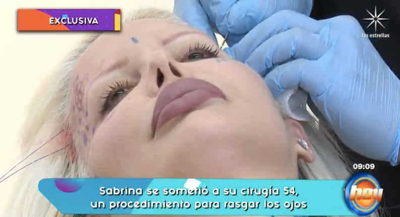 Sabrina Sabrok se somete a nueva cirugía estética