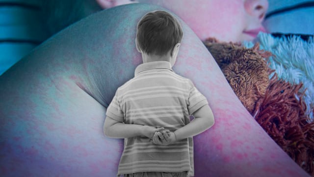 Niño muere en Tlaxcala por sarampión