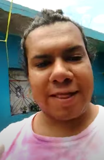 Kimberly Irene, la más preciosa antes de sus cirugías