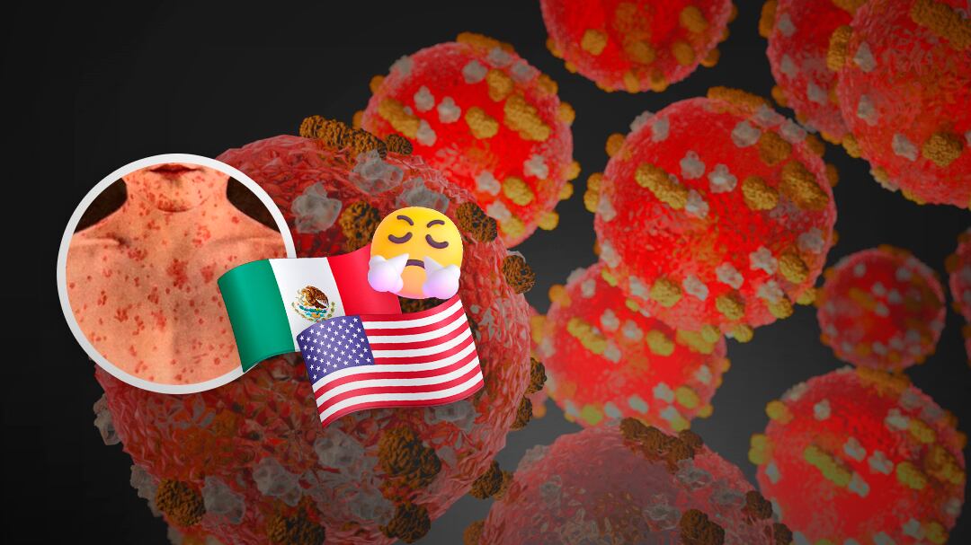 Estados Unidos se defendió de la crisis del sarampión tirándole tierra a México