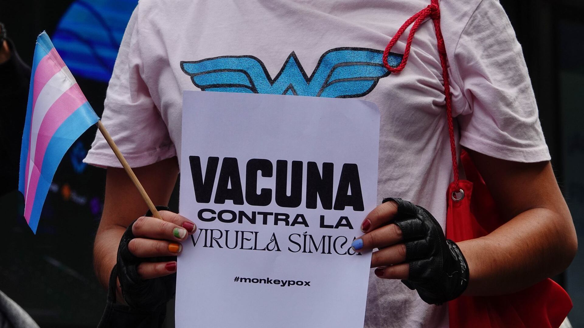 ¿Cuántos casos de viruela del mono mpox hay en México? La Secretaría de Salud confirmó el número de contagios