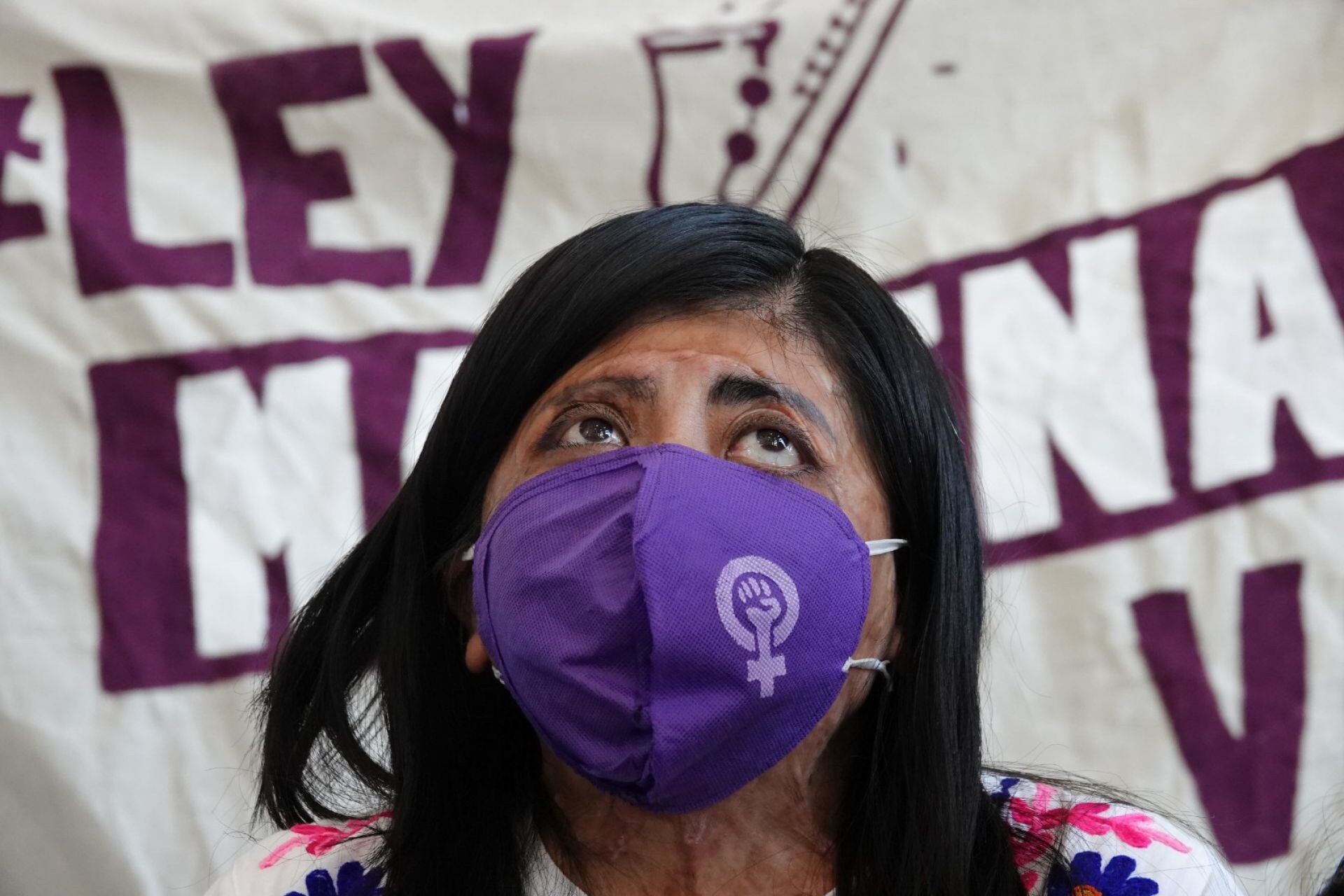 Elisa Xolalpa, víctima de ataque de ácido, en conferencia para presentar la Ley Malena