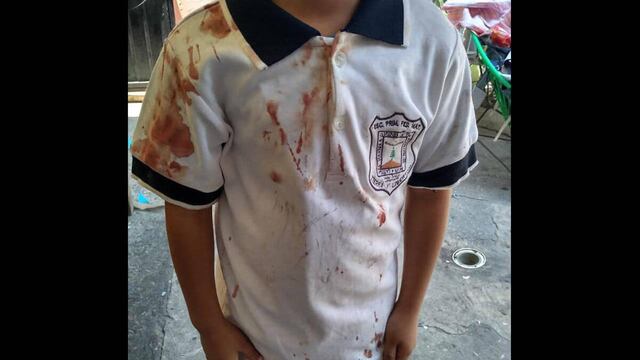 El menor de edad llegó a casa con el uniforme ensangrentado.