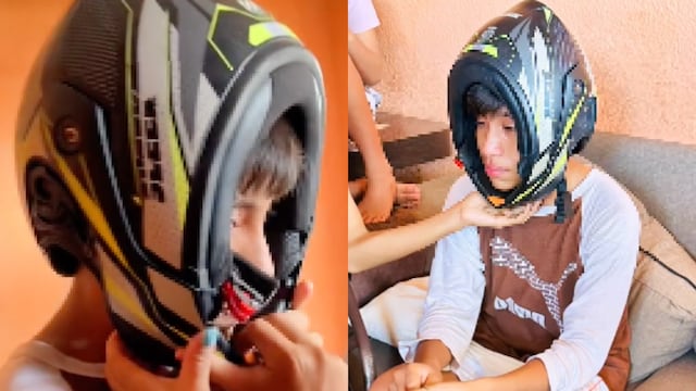 Joven se puso el casco de moto al revés y toda su familia no sabe cómo quitarselo.